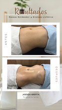 Cargar imagen en el visor de la galería, Programa Body Transformation Masaje Lipo 360